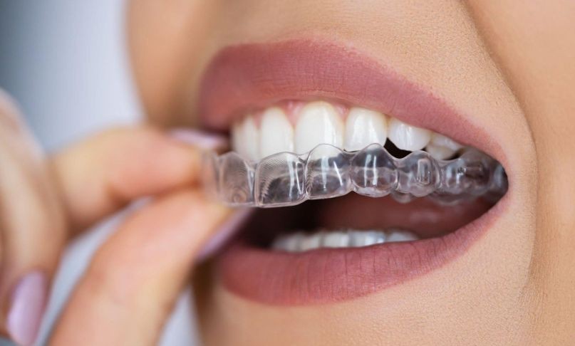 orthodontic2