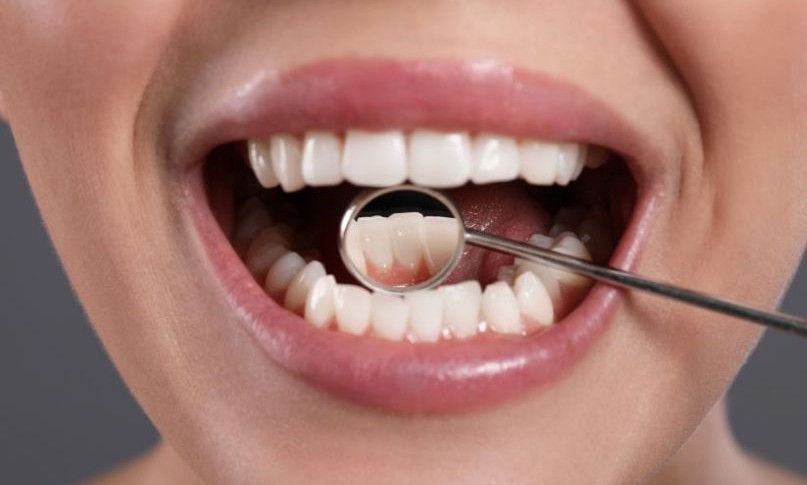 periodontal1