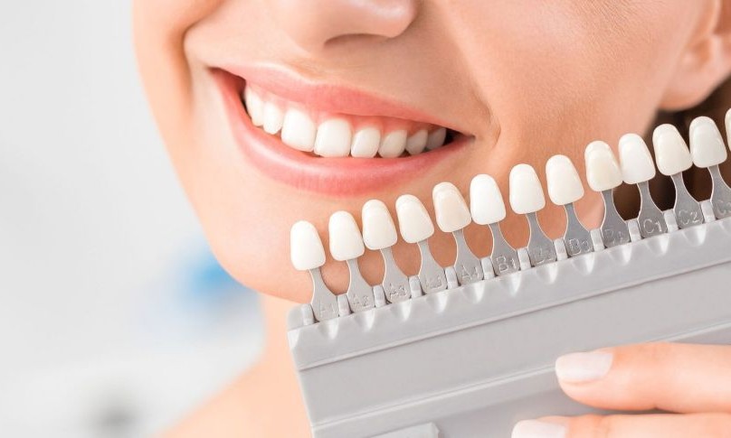 teeth whitening2